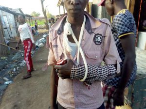 A victim had his hand struck with cane