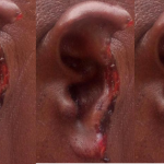 Woman Bites Rapist’s Tongue But Also Loses Ear In Horror Sex Attack
