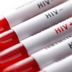 HIV TIME BOMB! Four Ugandans Catch Virus Every Hour, 54 Die Daily